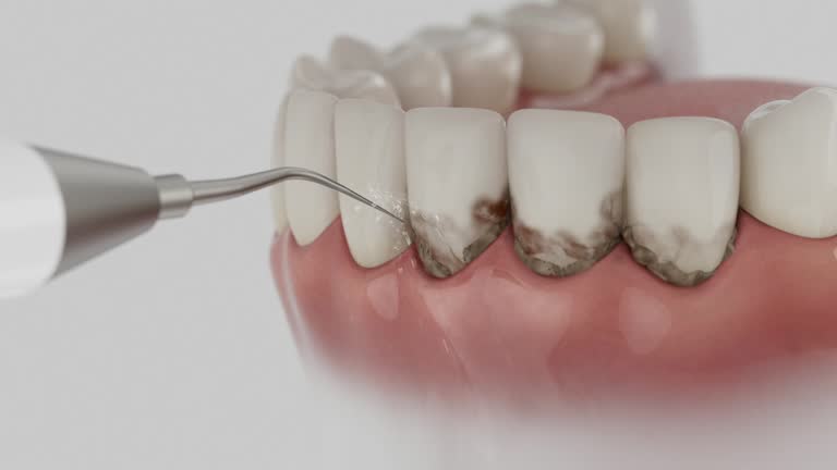 Reliable Emergency Dentist contractor in Baldwin, WI by Smile Center Dentistry